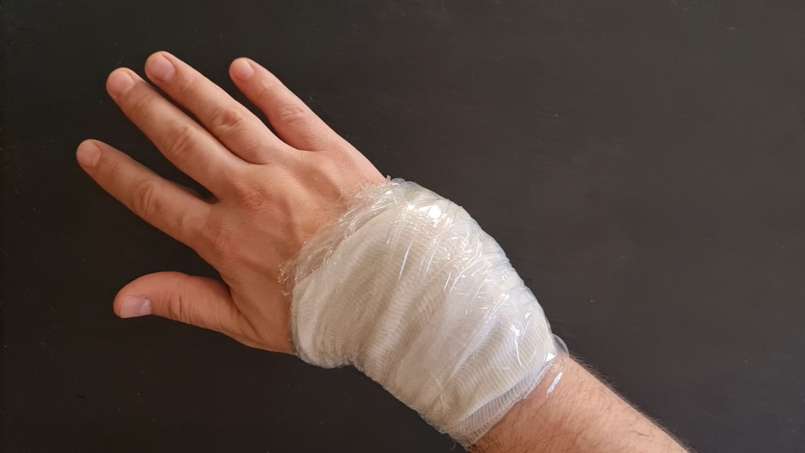 Kompres met loys en koolbladeren, foto 7